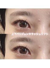 レディエント(Radiant)/上下パリジェンヌラッシュリフト