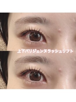 レディエント(Radiant)/上下パリジェンヌラッシュリフト