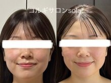 ご希望のお客様には、施術前後のお写真お渡ししております♪