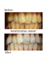 ホワイトニングショップ 葵区静岡駅店/ホワイトニング店ホワイトニング