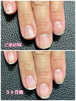 プルームネイル(plume.nail)/自爪育成