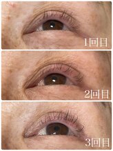 ラディユー(Radieux)/マイラミネーションお客様施術例