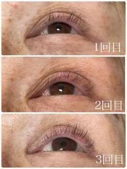 ラディユー(Radieux)/マイラミネーションお客様施術例