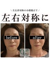 キュープ 富士店(Qpu)/左右差が気になったら、、