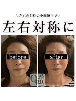 キュープ 富士店(Qpu)/左右差が気になったら、、