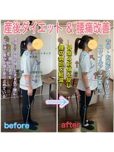 整体院ヒカリノキュウジツ さくら店/症例紹介★産後ケア＆腰痛改善