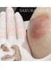 【夏限定】サクラメラ★バストトップ＋クリーム付き♪  170000円→50000円！ 