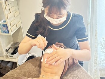 エル ブランシュ(Ailes blanches)の写真/【自分史上最高の美肌へ】美白/毛穴/シミケアに特化したホワイトスノーピールが受けられる◎
