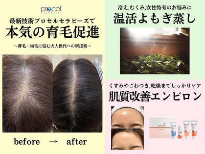 U エステティック 本山店の写真