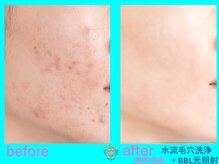 リュクス(LUXE)/ビフォーアフター