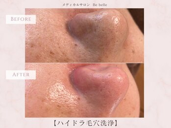 ビベル 八木店(Bebelle)/1回