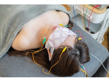 あかり鍼灸接骨院/電気を流す美容鍼【目力美鍼】