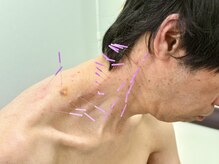 とだ鍼灸院/ムチ☆ウチ★長時間デスク仕事◎