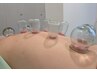 カッピング+ほぐしストレッチで浮腫み解消・デトックスコース