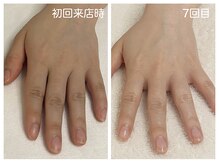 キレイテ 上野店/30代/7回目【ハンドケア稲荷町】