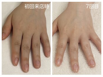 キレイテ 上野店/30代/7回目【ハンドケア稲荷町】