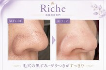 リッシュ(Riche)
