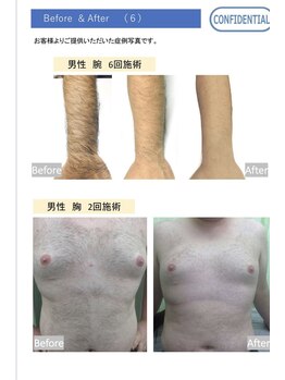 ムーウ(MuuU)/ビフォーアフター