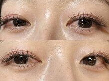 チッパー(CHIPPEr)/バインドロック