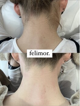 フェリモール(Felimor.)/シュガーリングbefore／after