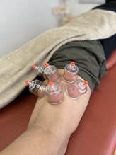 クガツヨッカ/◇カッピング♪