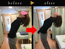 杉本接骨鍼灸院/若々しい背骨を取り戻す整体