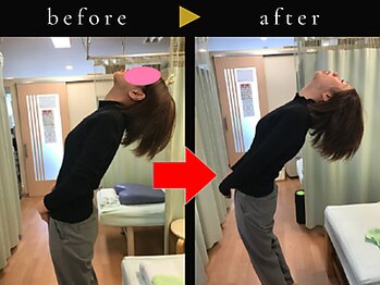 杉本接骨鍼灸院/若々しい背骨を取り戻す整体