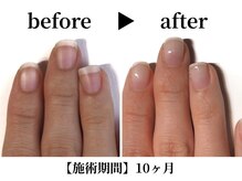 リング ザ ベル(ring the bell)/深爪スタンダードコース¥11,000