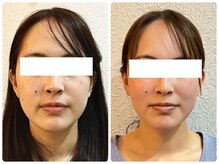 美容整体 ウェリナ 蟹江院/小顔矯正/骨盤矯正/美脚サロン