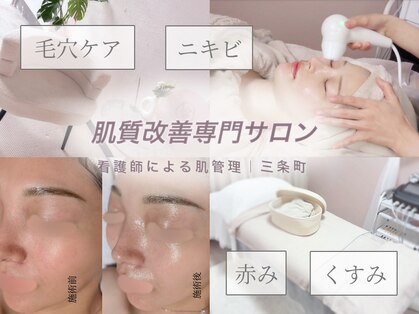 オンド(OND)の写真