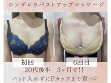 エスグレース 梅田店(S.grace)/シンデレラバストアップ施術