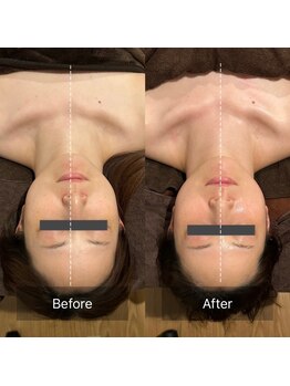 グレースフィオーレ 西宮北口店(gracefiore)/施術後Before/After 