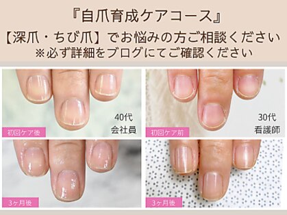 ルシェルアイの写真