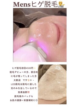 シュエット(Chouette)/ヒゲ脱毛 インスタに動画up中♪