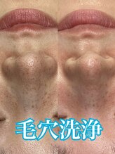 マルサンカクシカク(○△□)/