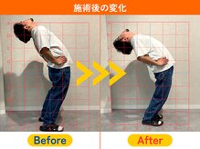 巣鴨駅前整体院/【施術後の変化】