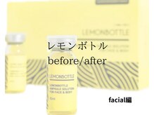 ジ エステティック イーズ ららぽーと福岡店/【レモンボトル】 喜びの変化！