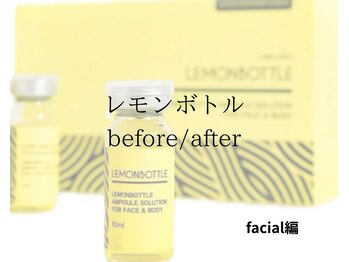 ジ エステティック イーズ ららぽーと福岡店/【レモンボトル】 喜びの変化！