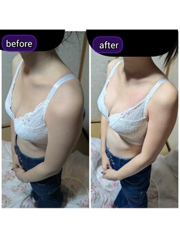 スノードロップ(snowdrop)/