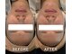 フローレ 平針店(Flore)の写真