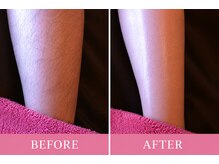 マロズワックス ブラジリアンワックスアンドスパ(Maro's Wax Brazilianwax Spa)/脚・ひざ下Wax★Before After