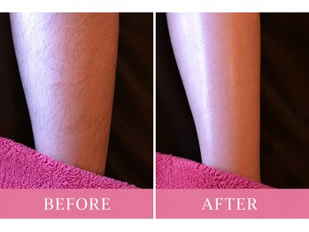 マロズワックス ブラジリアンワックスアンドスパ(Maro's Wax Brazilianwax Spa)/脚・ひざ下Wax★Before After