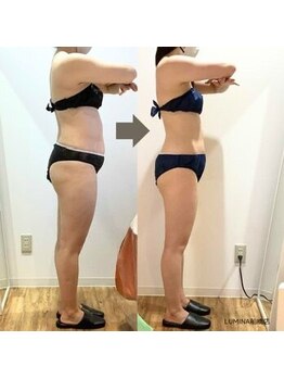 ルミナ ビューティーアンドリラックス(LUMINA Beauty&Relax)の写真/年齢を重ねて落ちなくなった二の腕ハミ肉をプロにお任せ！熟練スタッフの技術×高機能マシンで美ボディへ♪