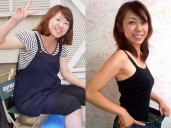 ラモ(ramo)/30代ビフォアフ