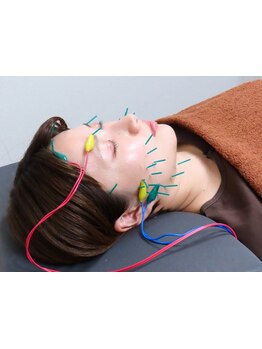 鍼灸施術を受けたい