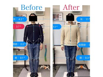 ナオル整体 名古屋金山院(NAORU整体)/【金山】姿勢とコリを解消
