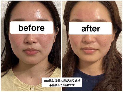 グリーン鍼灸整体院(green鍼灸整体院)の写真