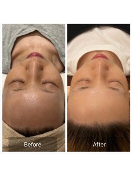 ウィズ ユー ビューティ(with U beauty)/続けるほど綺麗に