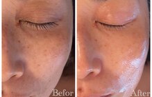 アールヨンマルハチ フェイスアンドアイ(R408.face&eye)