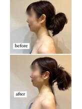 ビンナ 五反田店(Binna)/ストレートネック改善